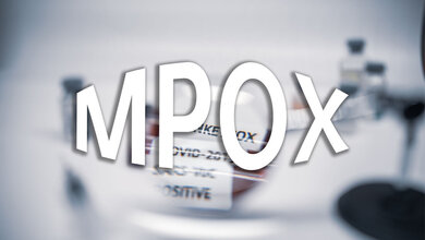 Schrift zeigt MPox