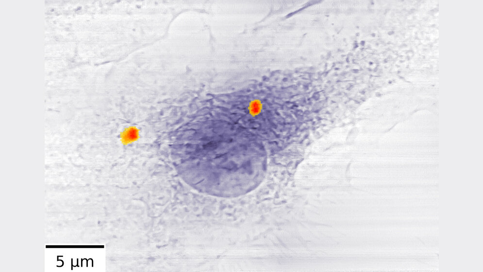 Zwei Ansammlungen von Antibiotika-beladenen Eisen-Nanocontainern 