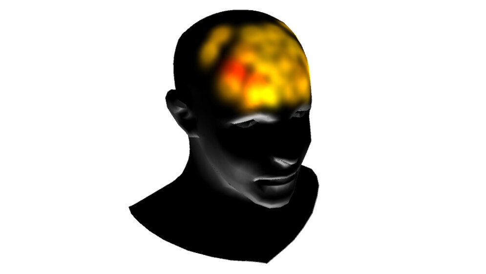 Ein Blick ins Gehirn mit fNIRS