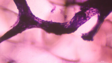 Eingefärbte Zellkultur (lila) auf dem neu entwickelten 3D-Silkongitter