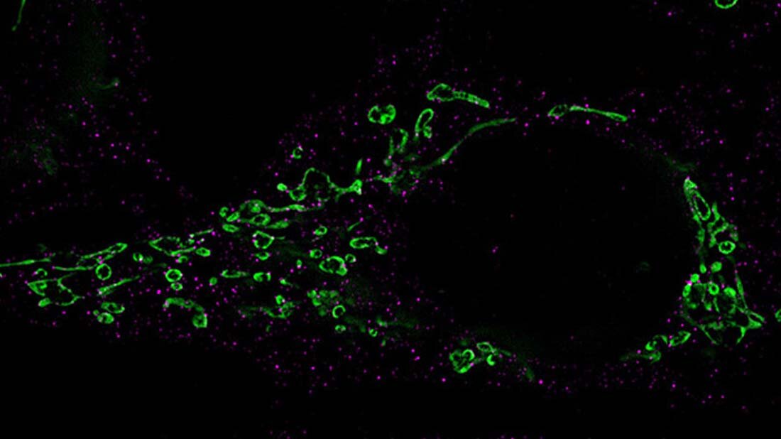 Reaktivierung von Herpesviren erforscht