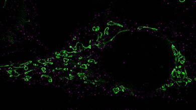 Reaktivierung von Herpesviren erforscht