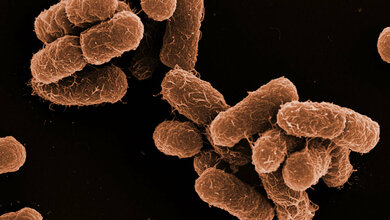 Elektronenmikroskopische Aufnahme von Klebsiella oxytoca. 