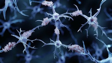 Weltalzheimertag_2.jpg Alzheimerforschung immer effektiver