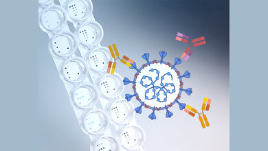 Microarray.jpg Einsatz eines Microarrays zur Detektion verschiedenster Antikörper