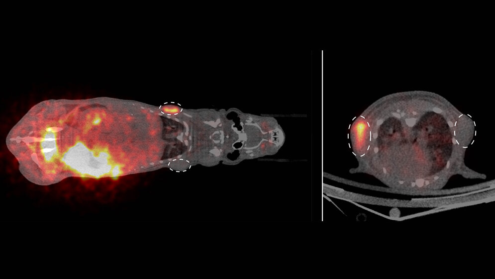 PET-Bildgebung von Tumoren
