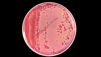 Klebsiella pneumoniae auf MacConkey-Agar 