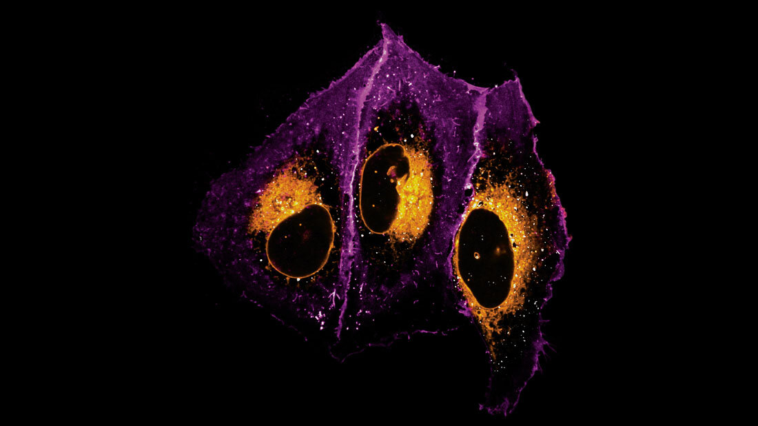 Eine Mikroskopieaufnahme menschlicher Knochenzellen.