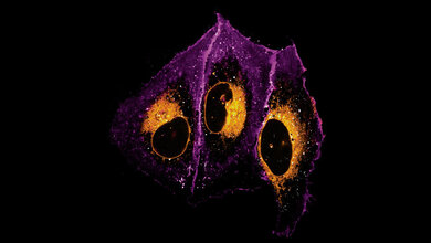 Eine Mikroskopieaufnahme menschlicher Knochenzellen.