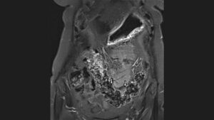 Titelbild des Fachbeitrags zur Bildgebung beim Colon elongatum