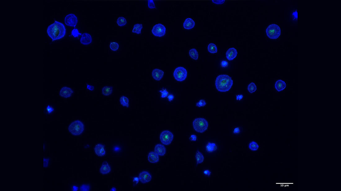 Dargestellt sind retikulierte Bluttplättchen unter dem Mikroskop.