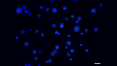 Dargestellt sind retikulierte Bluttplättchen unter dem Mikroskop.