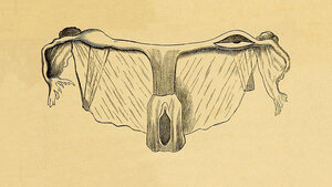 Historische Zeichnung der weiblichen Geschlechtsorgane. Illustration aus: Hewitt G: Diagnose, Pathologie und Therapie der Frauen-Krankheiten