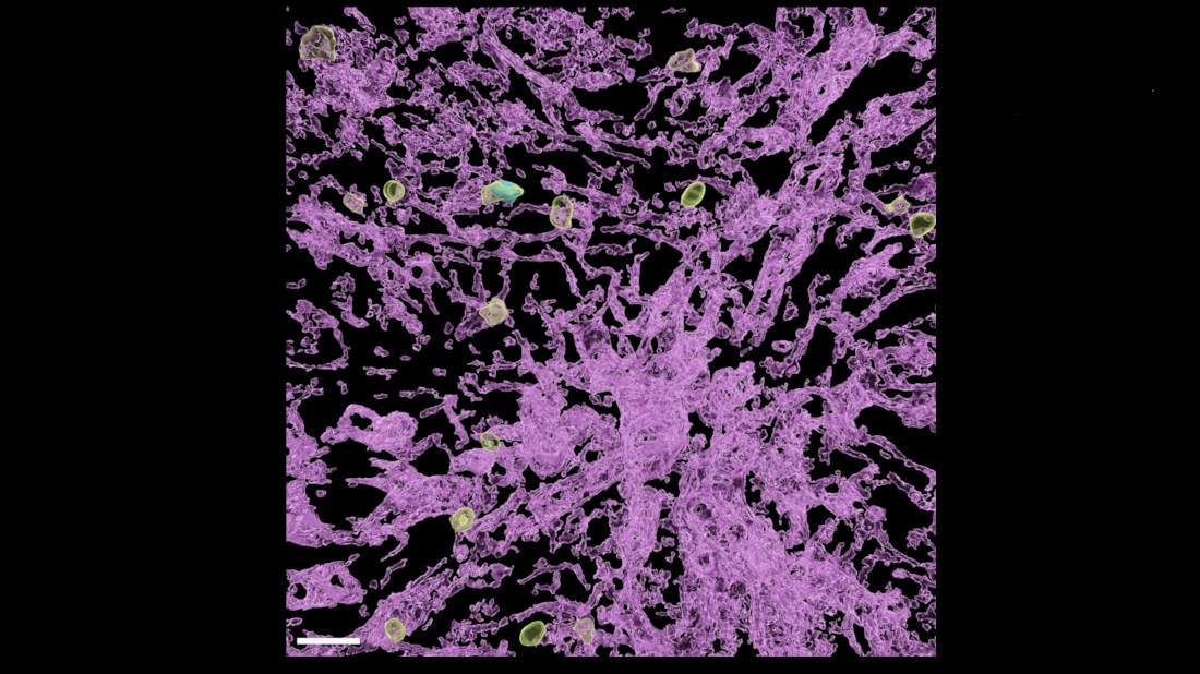 Eine Virus-spezifische T-Zelle im Gefäßsystem der Leber. 