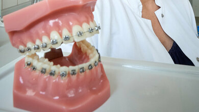 Zahnspangen_loesen_kaum_Allergien_aus_obwohl_sie_Nickel_enthalten_Foto_Volker_Lannert_Uni_Bonn_20052016.jpg Zahnspangen