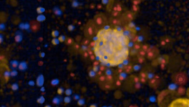 Mikroskopisches Bild eines Lungentumors in gelb, der von Car-T-Zellen in blau angegriffen wird.