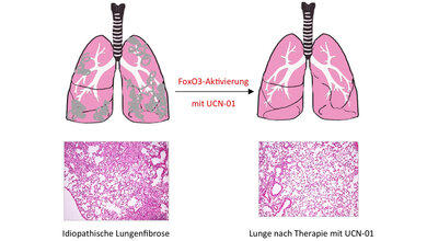 Neuer_Behandlungsansatz_gegen_Lungenfibrose_MPI_Herz_Lungenforschung.jpg Neuer Behandlungsansatz gegen Lungenfibrose