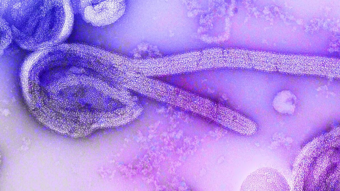 marburg.jpg Marburg-Virus
