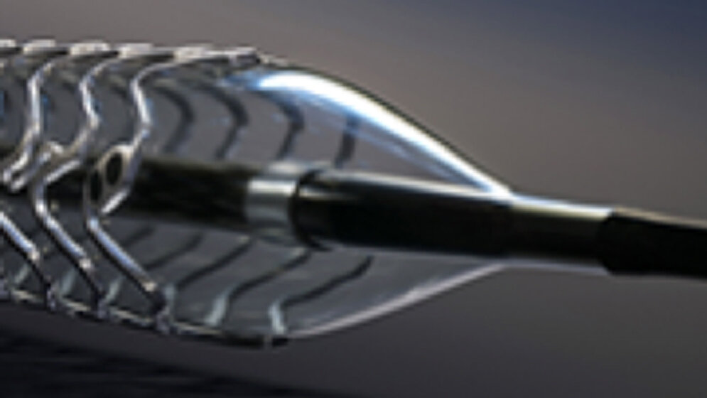 mg_20stent.jpg Stents