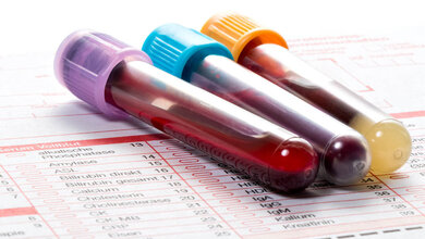 Labortests