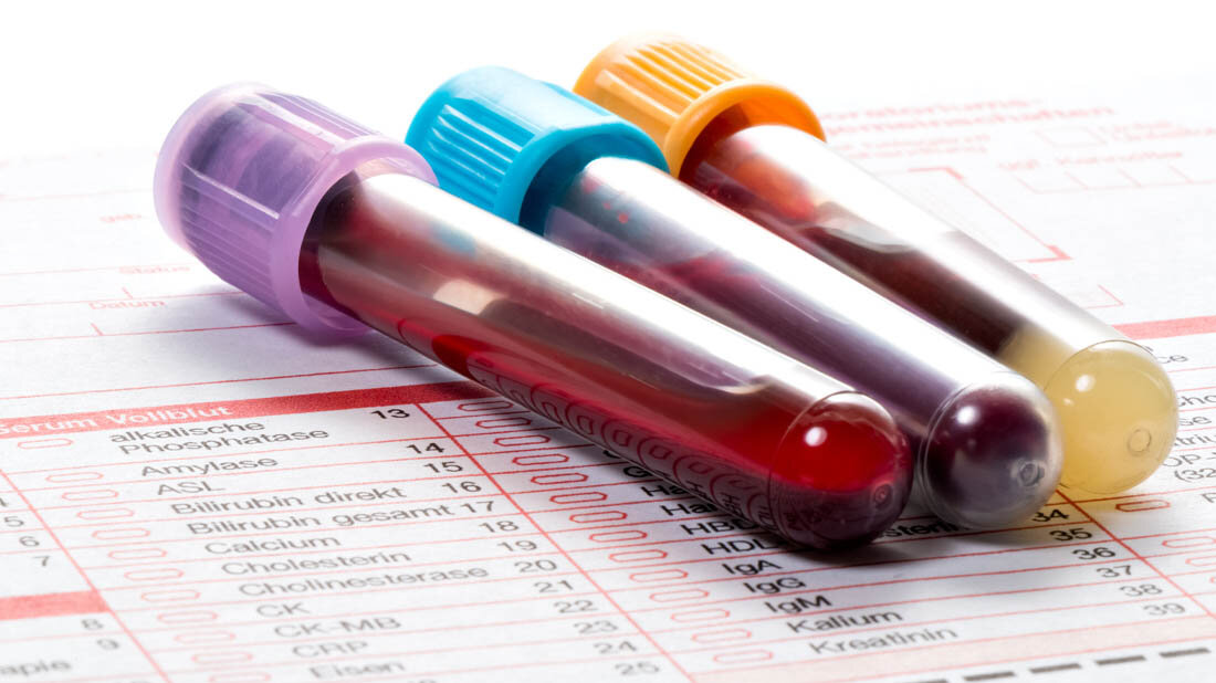Labortests