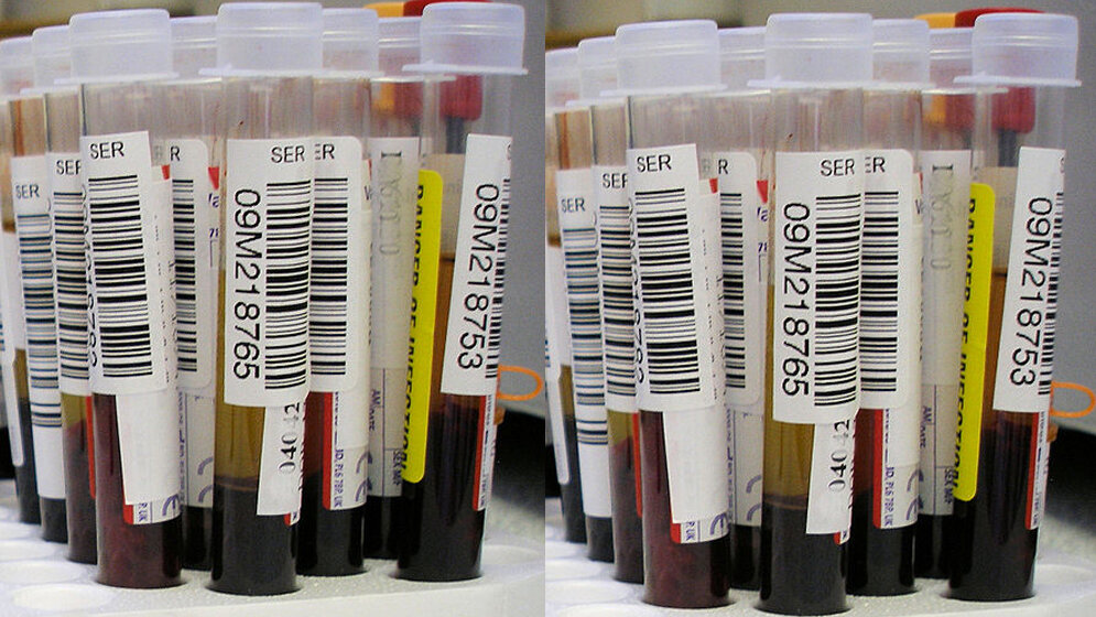Liquid Biopsy