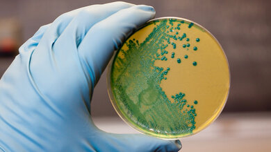 Hand mit Schutzhandschuh hält eine Petrischale, in der Bakterien ausgestrichen sind.