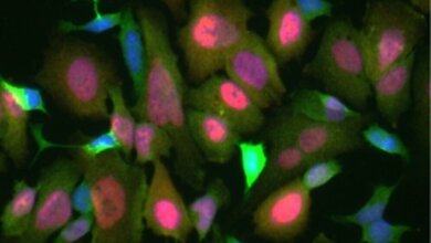 Neuroblastom-Zellen.