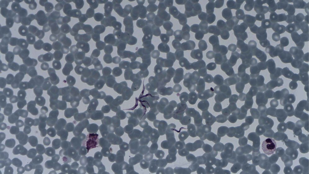 Trypanosoma brucei 