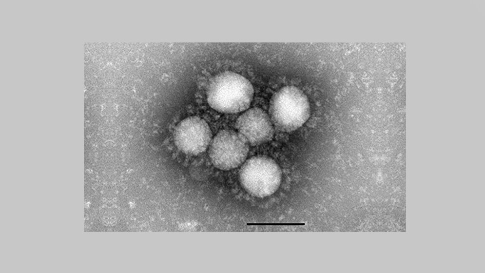 Coronavirus (2019-nCoV) 