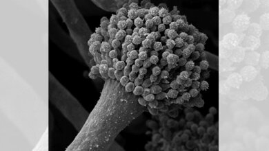 Aspergillus fumigatus