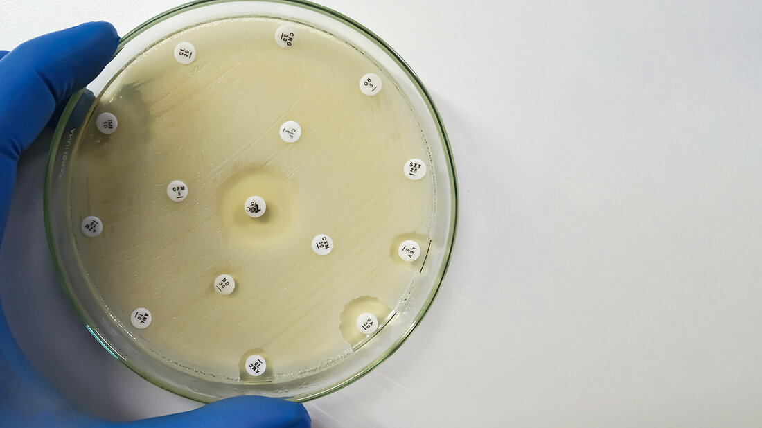 Petrischale mit bakterieller Kultur und Antibiotika-Testplättchen zur Untersuchung der Empfindlichkeit gegenüber verschiedenen Wirkstoffen.