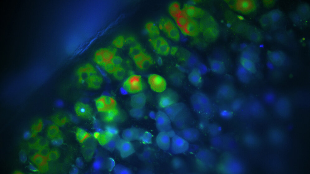 Kalzium-Messungen von Aldosteron-produzierenden Zellen
