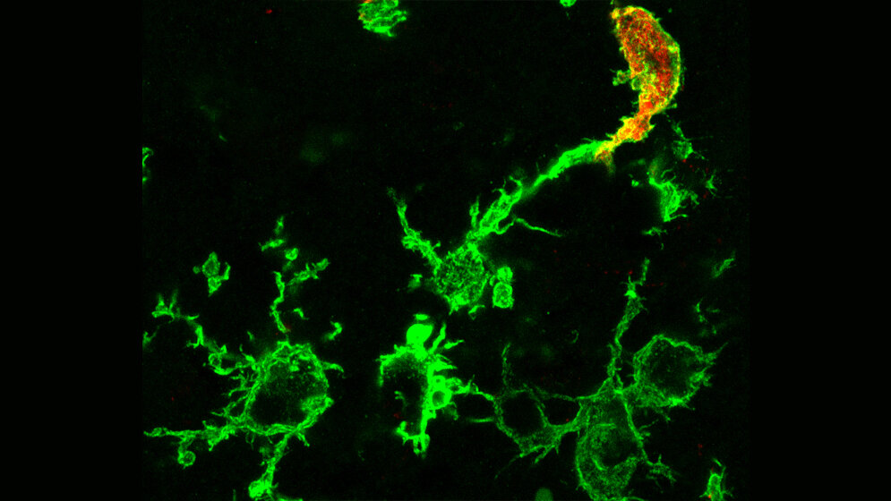 Mikroskopisches Bild von grün angefärbten Makrophagen