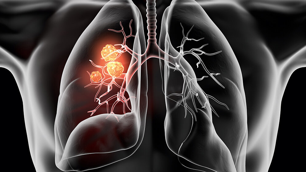 Immunzytochemische Diagnostik