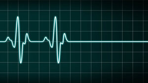 Abbildung einer Herzrhythmuskurve, die in eine Gerade übergeht