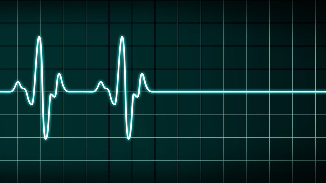 Abbildung einer Herzrhythmuskurve, die in eine Gerade übergeht