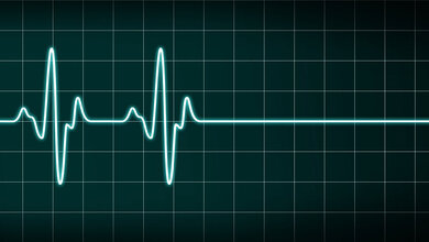 Abbildung einer Herzrhythmuskurve, die in eine Gerade übergeht
