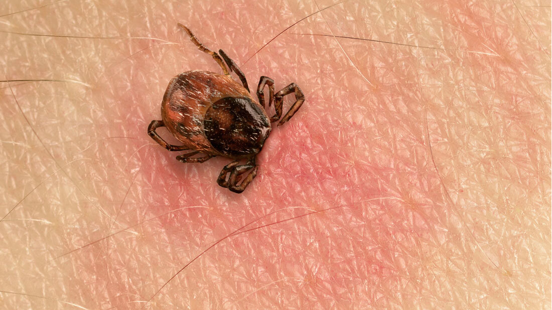 Zeckenstich mit Wanderröte.