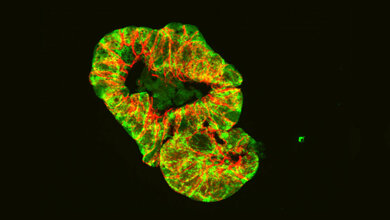 Mikroskopische Aufnahme eines Darm-Organoids