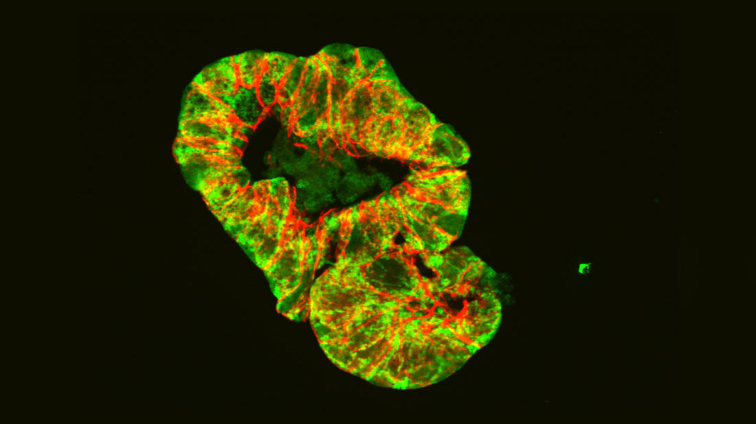 Mikroskopische Aufnahme eines Darm-Organoids