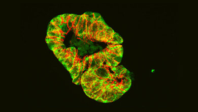 Darm_Organoid.jpg Mikroskopische Aufnahme eines Darm-Organoids