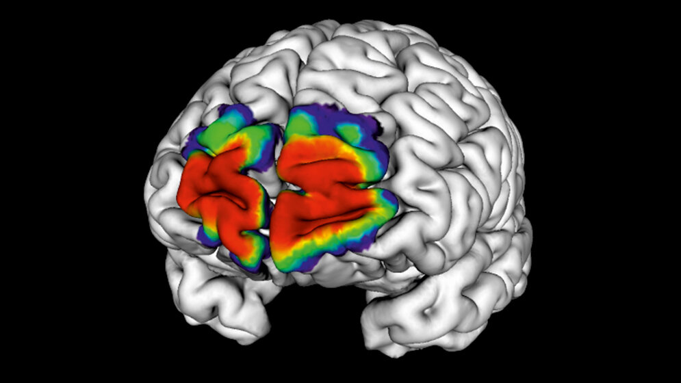 JuBrainAtlas_Forschungszentrum_Jüling_HBP.jpg JuBrain