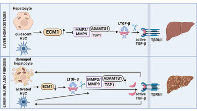 Leberfibrose_ECM1.jpg Leberfibrose
