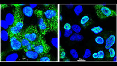 Mikroskopische Aufnahme menschlicher Zellen nach Infektion mit Grippeviren
