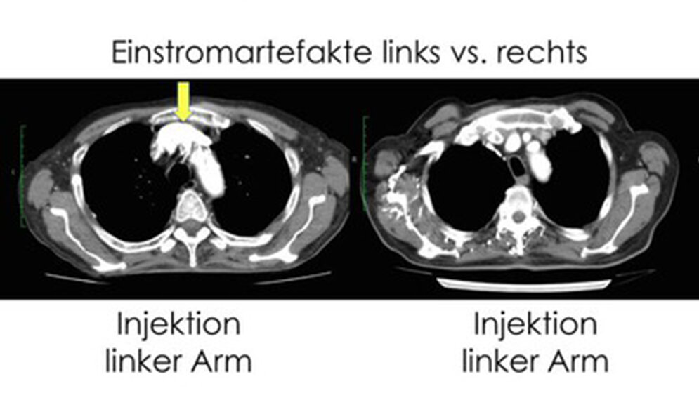 Tipps und Tricks für eine erfolgreiche CT-Angiographie Bildgebende Verfahren