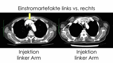 Bildgebende Verfahren