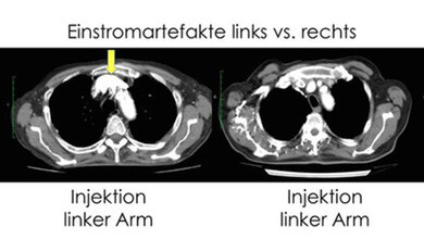 Tipps und Tricks für eine erfolgreiche CT-Angiographie Bildgebende Verfahren