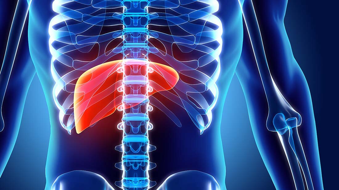Zwei Drittel aller mit einer Leberzirrhose hospitalisierten Patienten sind männlich.