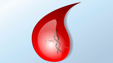 Liquid Biopsy